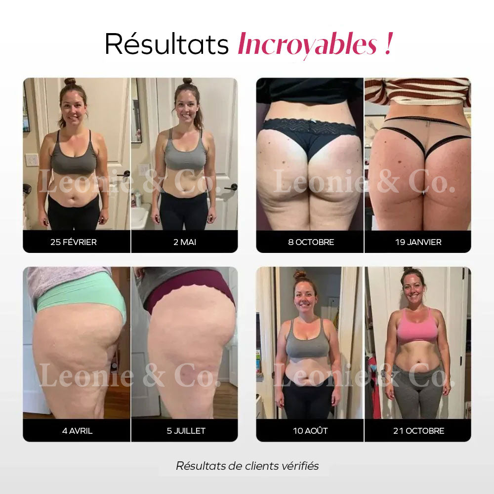 Legging 3D Anti-Cellulite